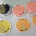 colored_bacteria.jpg