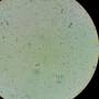 microcystis-aeruginosa.jpg